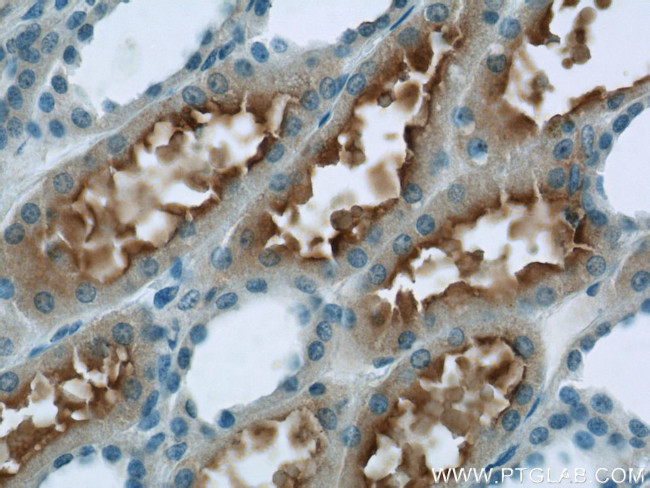 PHF14 Antibody in Immunohistochemistry (Paraffin) (IHC (P))