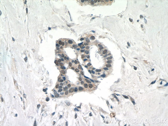 INO80C Antibody in Immunohistochemistry (Paraffin) (IHC (P))