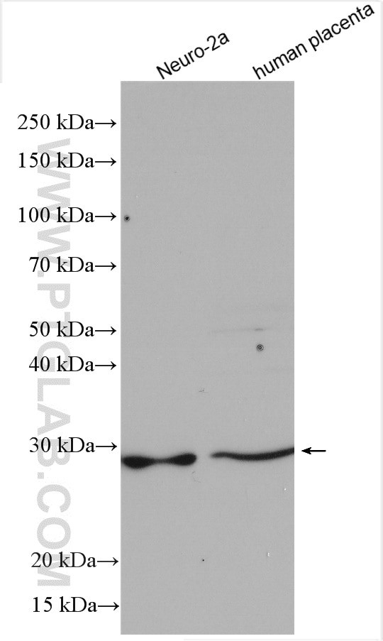 C15orf29 Antibody in Western Blot (WB)
