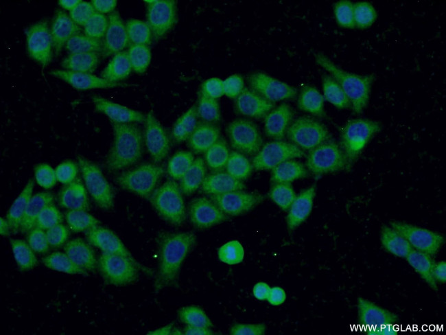 C19orf61 Antibody in Immunocytochemistry (ICC/IF)