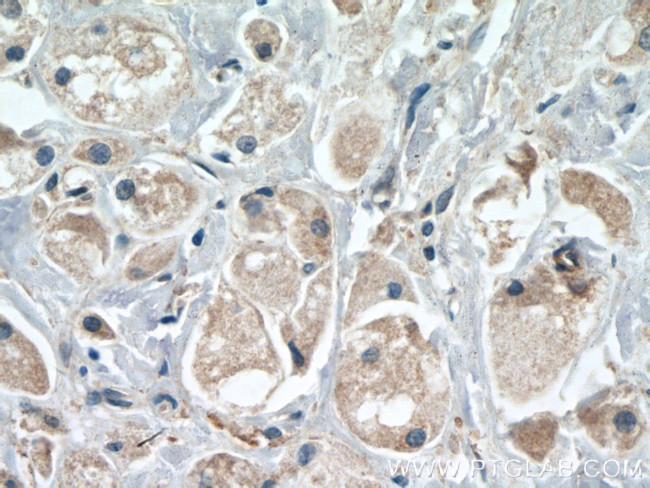 TMEM179 Antibody in Immunohistochemistry (Paraffin) (IHC (P))