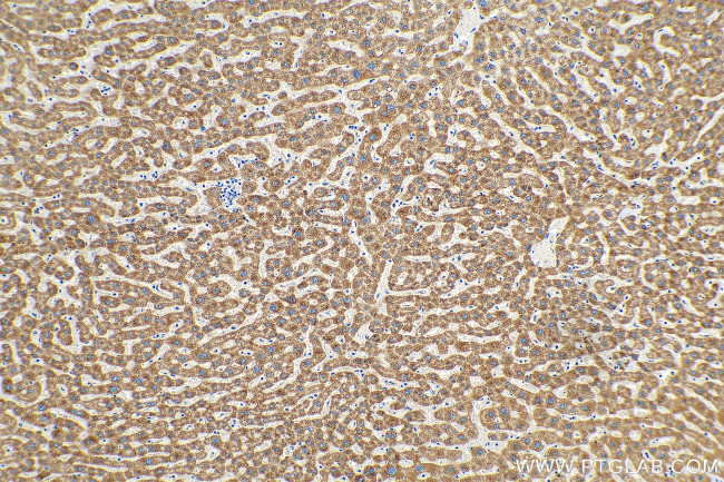 PXMP2 Antibody in Immunohistochemistry (Paraffin) (IHC (P))