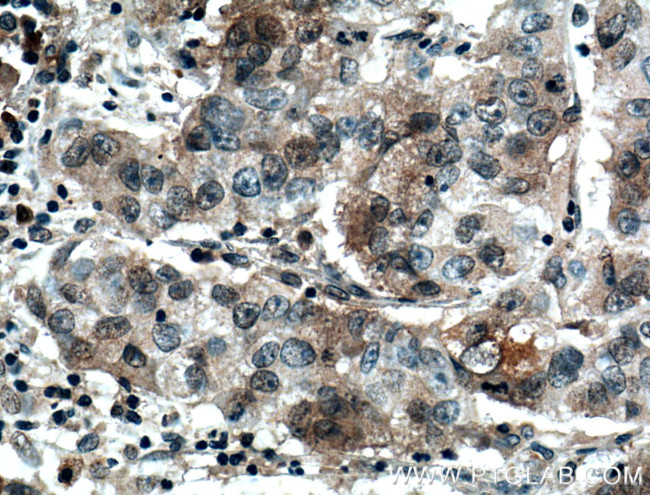 FAM174A Antibody in Immunohistochemistry (Paraffin) (IHC (P))