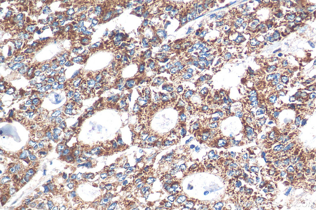 STEAP2 Antibody in Immunohistochemistry (Paraffin) (IHC (P))