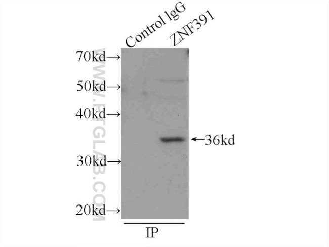 ZNF391 Antibody in Immunoprecipitation (IP)