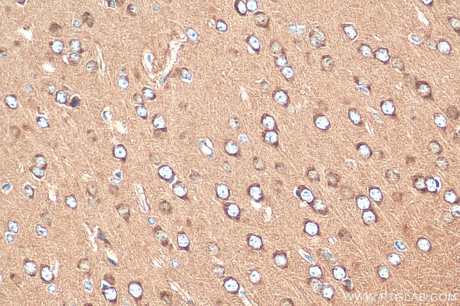 NPTXR Antibody in Immunohistochemistry (Paraffin) (IHC (P))