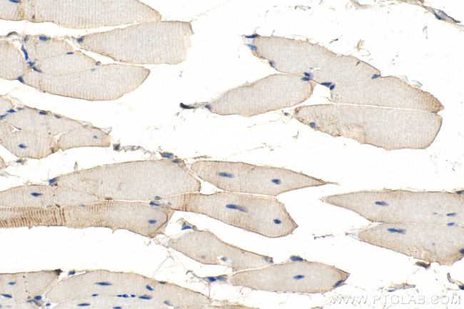 C1orf111 Antibody in Immunohistochemistry (Paraffin) (IHC (P))