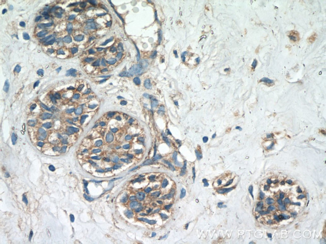TMEM154 Antibody in Immunohistochemistry (Paraffin) (IHC (P))