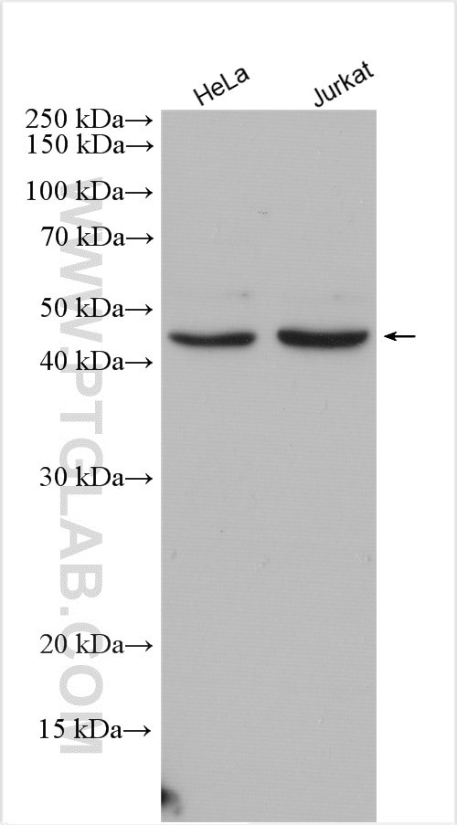 ZRANB2 Antibody in Western Blot (WB)