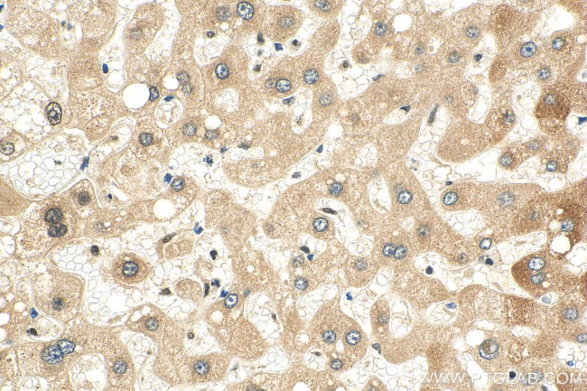 USP50 Antibody in Immunohistochemistry (Paraffin) (IHC (P))