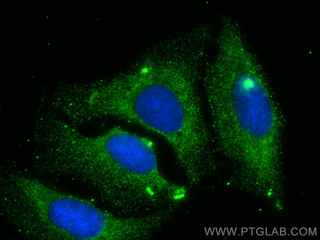 C1RL Antibody in Immunocytochemistry (ICC/IF)
