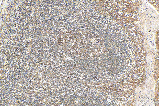 ATXN2L Antibody in Immunohistochemistry (Paraffin) (IHC (P))