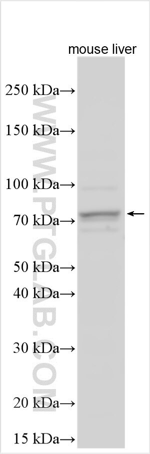 LPPR4 Antibody in Western Blot (WB)