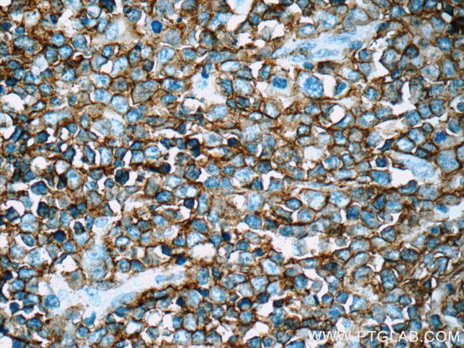 CD20 Antibody in Immunohistochemistry (Paraffin) (IHC (P))