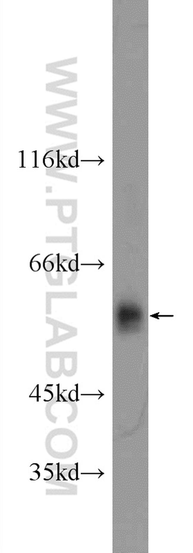 ARMC5 Antibody in Western Blot (WB)