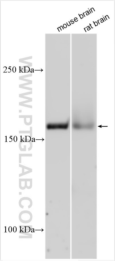 LRRC4 Antibody in Western Blot (WB)