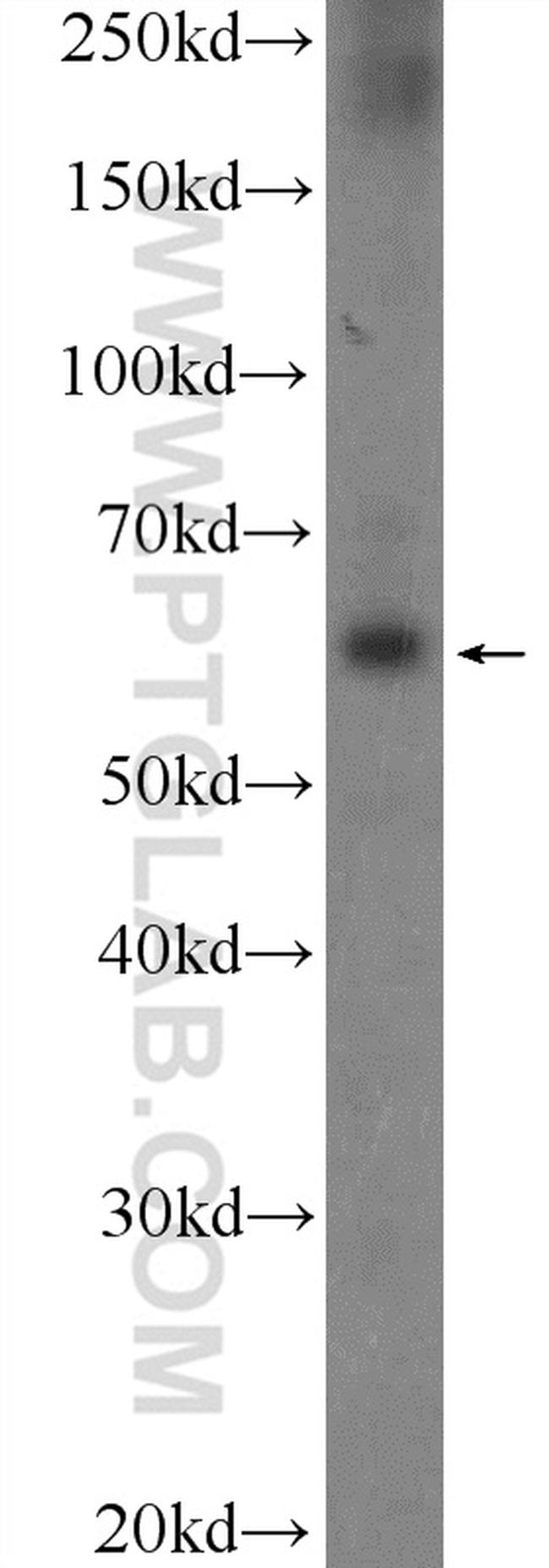 POTEH Antibody in Western Blot (WB)