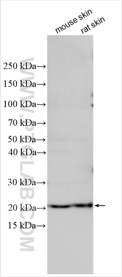 TNN Antibody in Western Blot (WB)