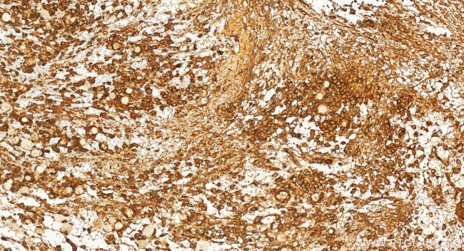 SZRD1 Antibody in Immunohistochemistry (Paraffin) (IHC (P))