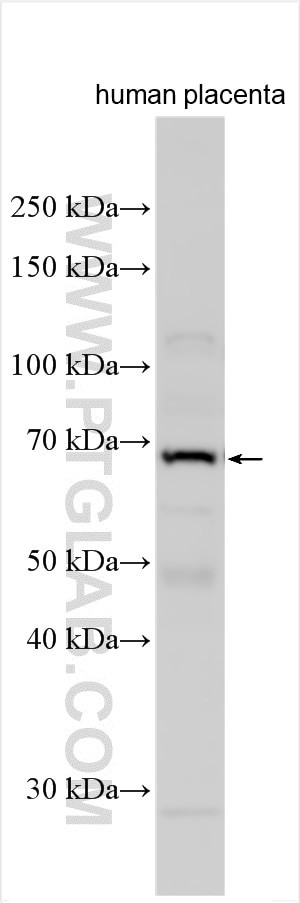 Spartan Antibody in Western Blot (WB)
