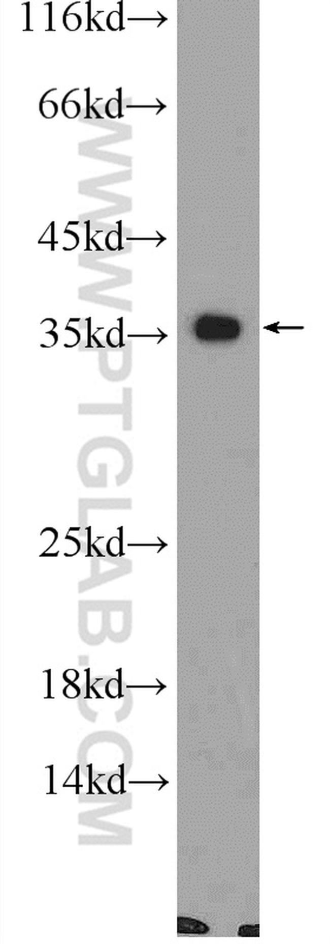 CNTD1 Antibody in Western Blot (WB)