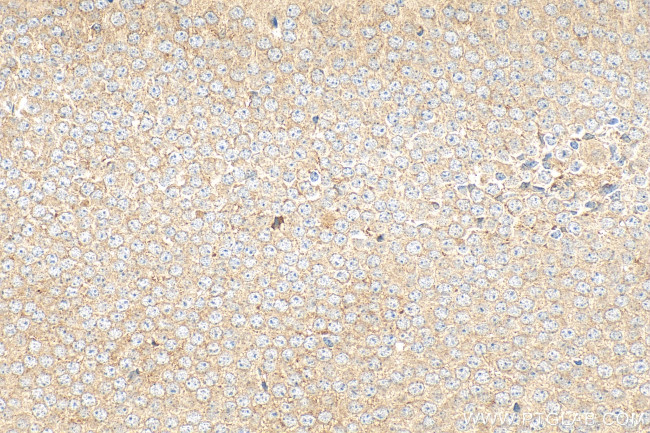 GPR45 Antibody in Immunohistochemistry (Paraffin) (IHC (P))