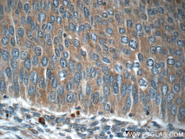 C13orf37 Antibody in Immunohistochemistry (Paraffin) (IHC (P))