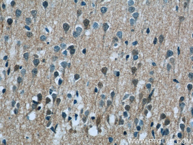 LRCH2 Antibody in Immunohistochemistry (Paraffin) (IHC (P))