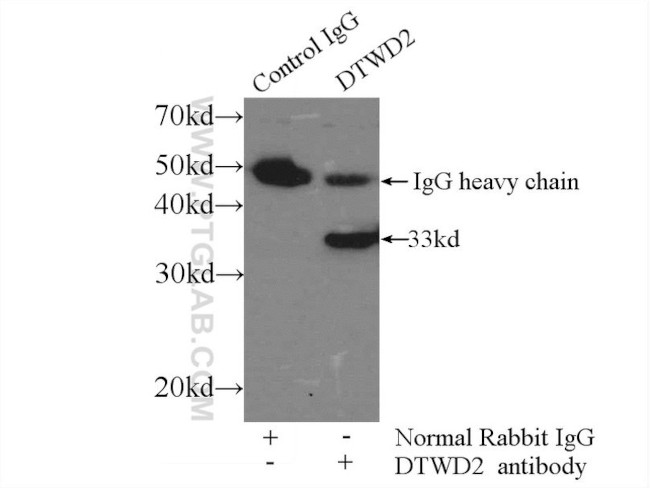 DTWD2 Antibody in Immunoprecipitation (IP)