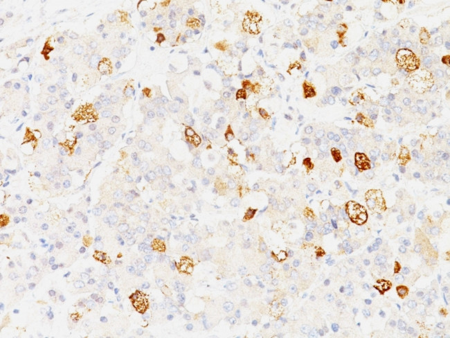 FSH-beta (Follicle Stimulating Hormone-beta) Antibody in Immunohistochemistry (Paraffin) (IHC (P))