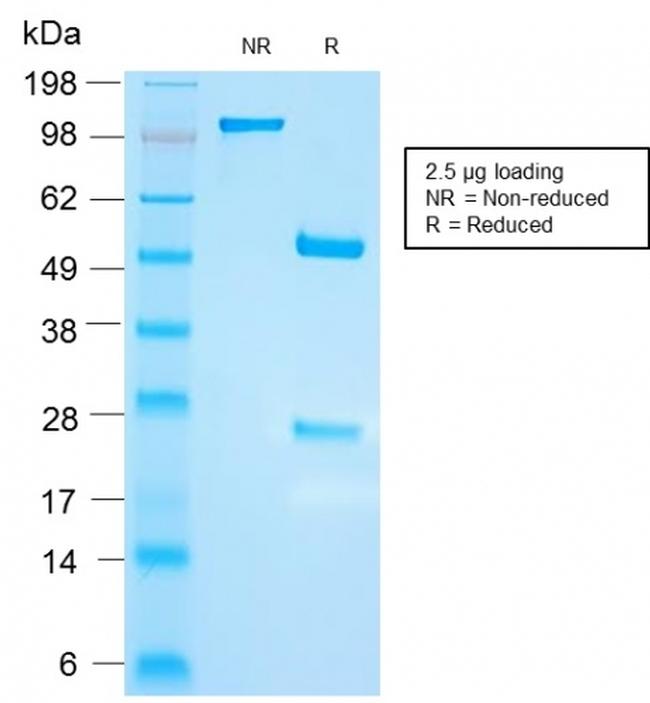 FSH-beta (Follicle Stimulating Hormone-beta) Antibody in SDS-PAGE (SDS-PAGE)