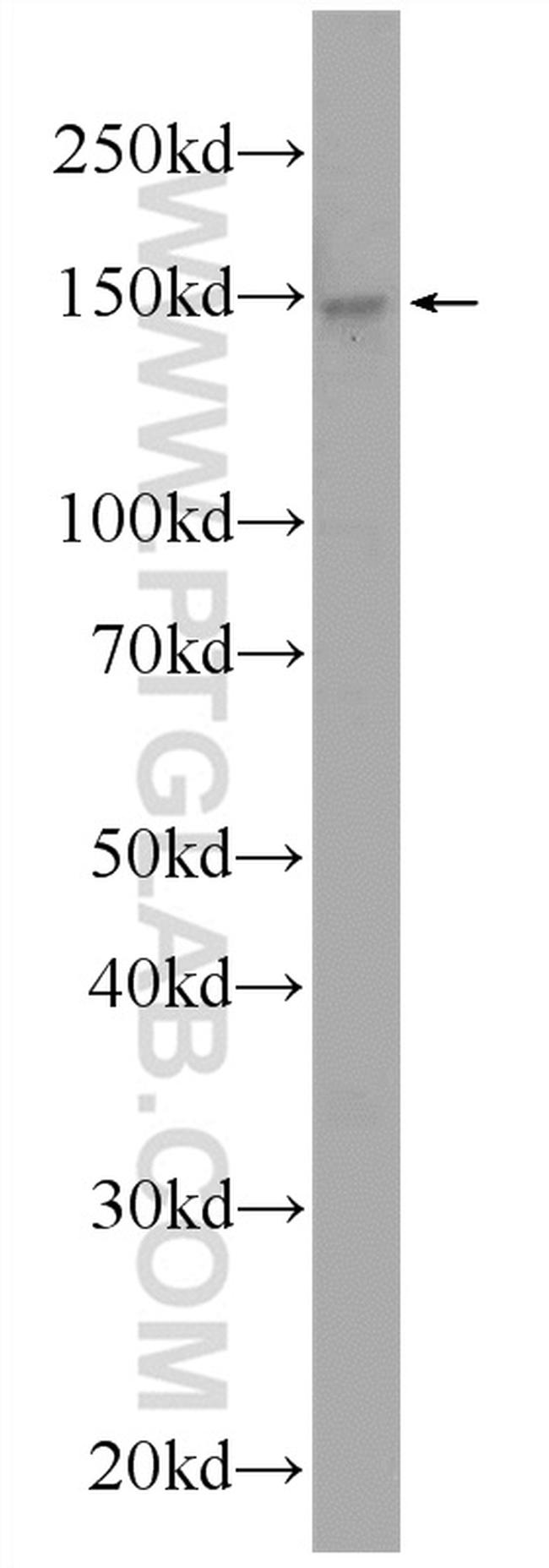 URB2 Antibody in Western Blot (WB)