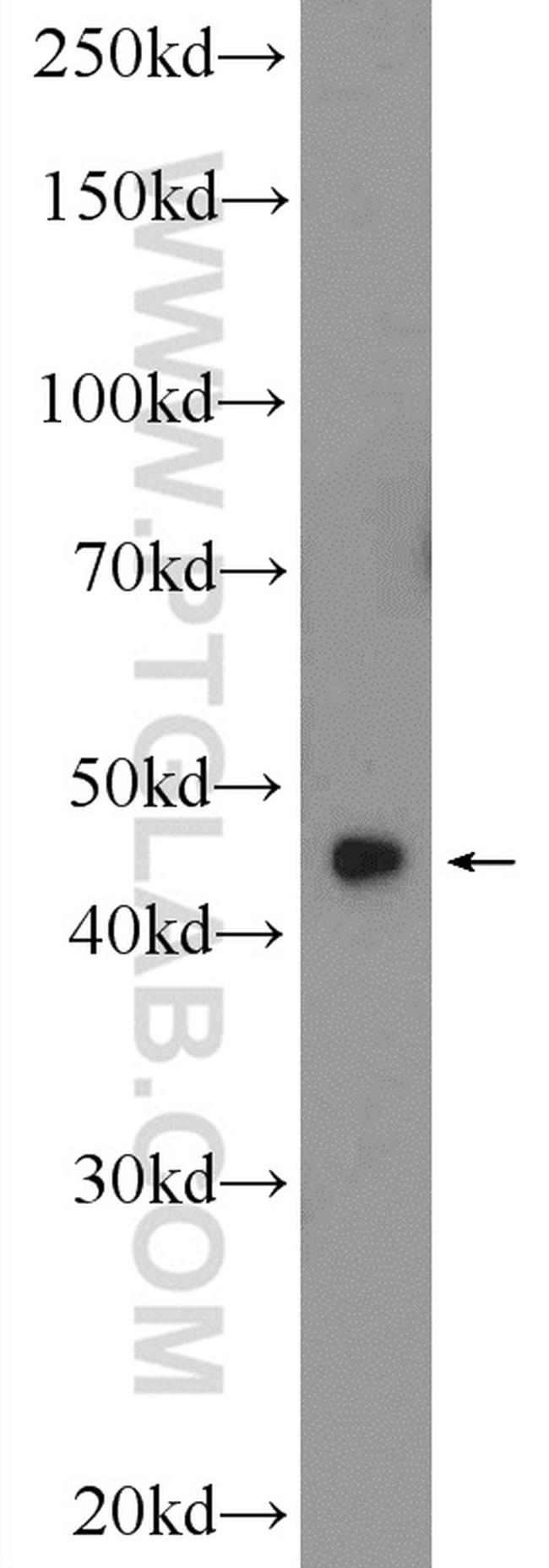 ZNF320 Antibody in Western Blot (WB)
