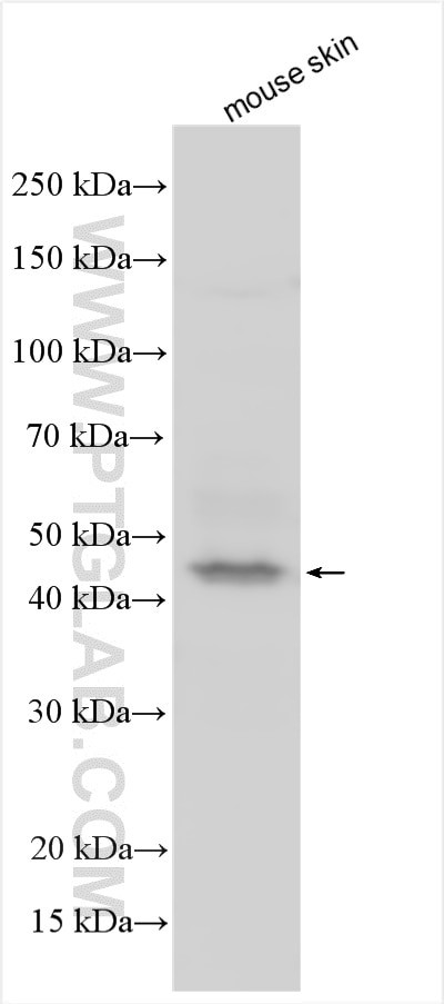 C1orf161 Antibody in Western Blot (WB)