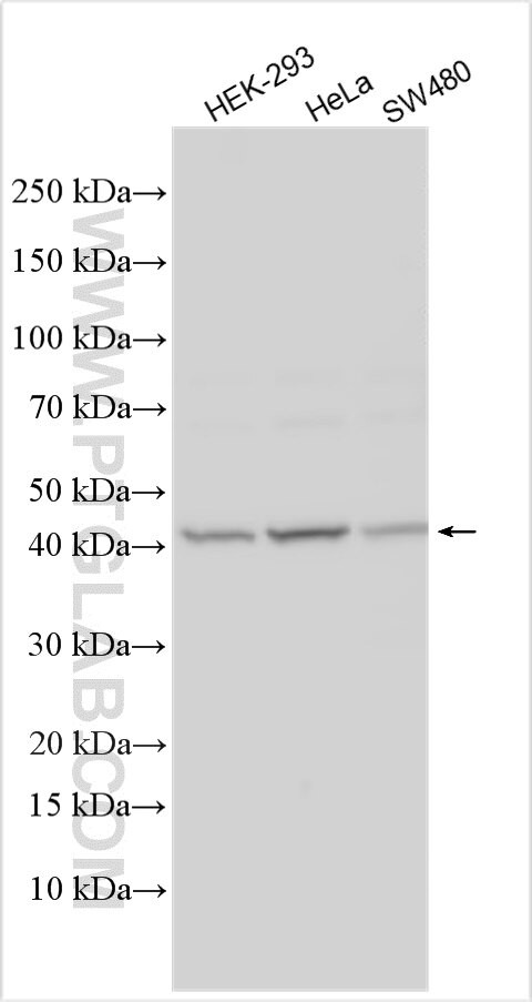 TTC39C Antibody in Western Blot (WB)