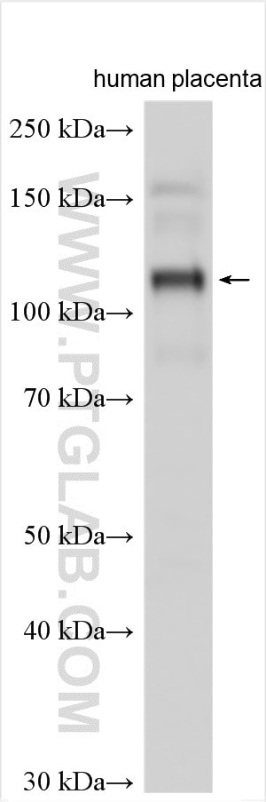 ANKFY1 Antibody in Western Blot (WB)