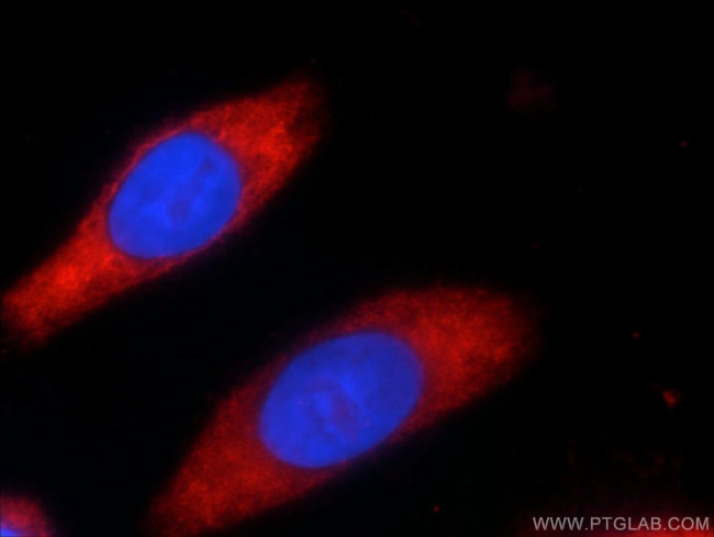 GEMIN5 Antibody in Immunocytochemistry (ICC/IF)