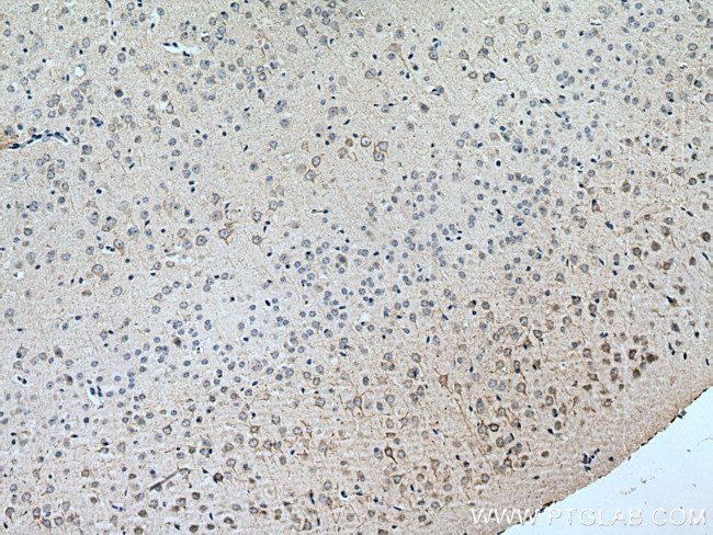 TMEM161A Antibody in Immunohistochemistry (Paraffin) (IHC (P))
