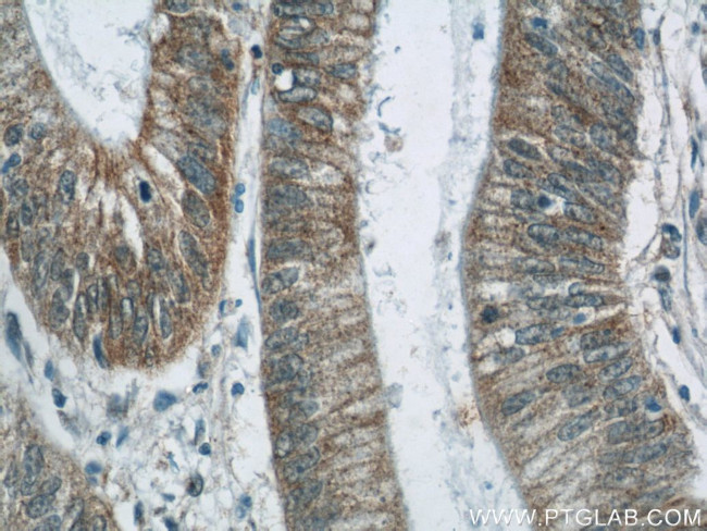 TMEM190 Antibody in Immunohistochemistry (Paraffin) (IHC (P))