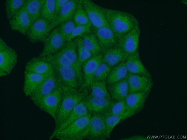 GRAMD1B Antibody in Immunocytochemistry (ICC/IF)