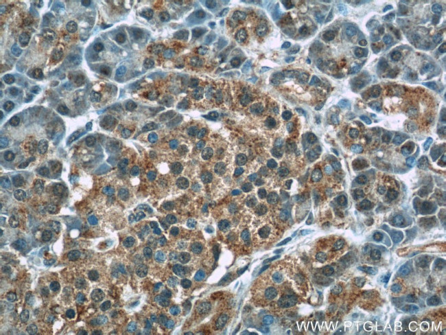 WFDC3 Antibody in Immunohistochemistry (Paraffin) (IHC (P))