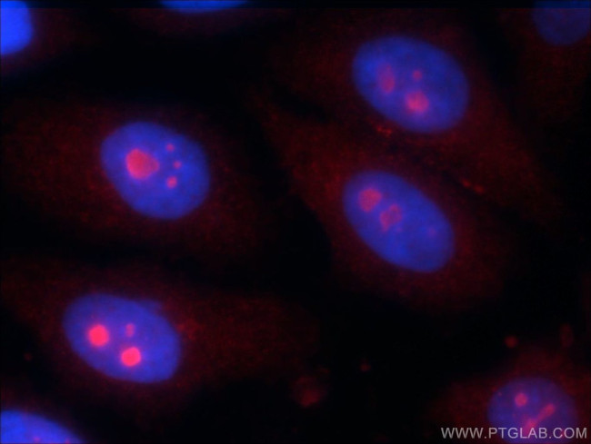KIAA0774 Antibody in Immunocytochemistry (ICC/IF)