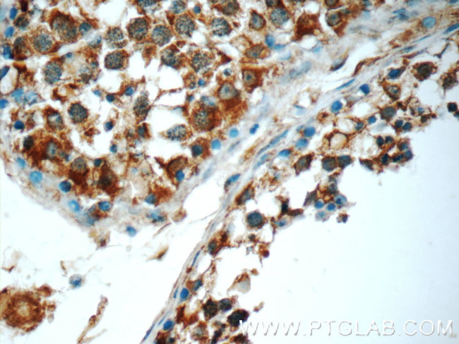 TMEM213 Antibody in Immunohistochemistry (Paraffin) (IHC (P))