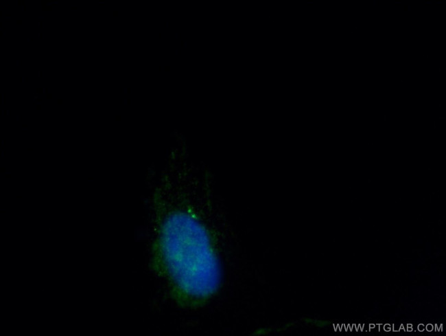 CEP112 Antibody in Immunocytochemistry (ICC/IF)