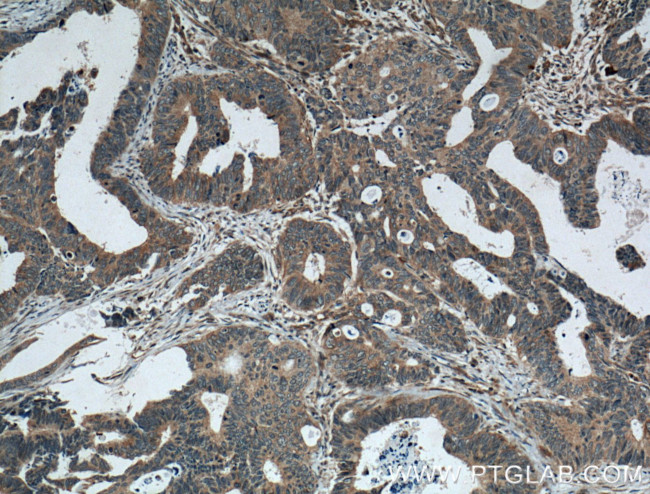 FAM155A Antibody in Immunohistochemistry (Paraffin) (IHC (P))