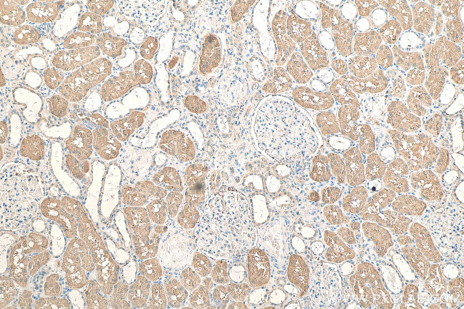 C2orf47 Antibody in Immunohistochemistry (Paraffin) (IHC (P))