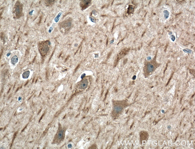 SRBD1 Antibody in Immunohistochemistry (Paraffin) (IHC (P))