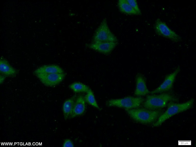 SEC61alpha Antibody in Immunocytochemistry (ICC/IF)
