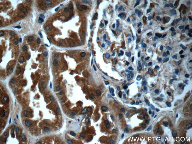 FPGT Antibody in Immunohistochemistry (Paraffin) (IHC (P))