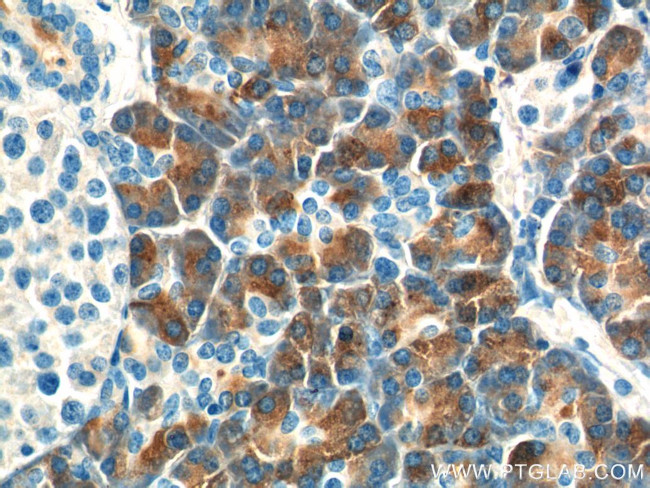 CTRB1 Antibody in Immunohistochemistry (Paraffin) (IHC (P))